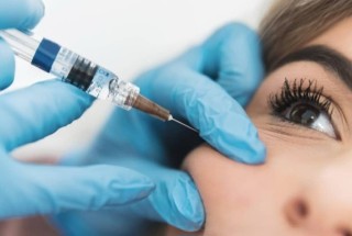 Restylane täyteainehoidot, posket